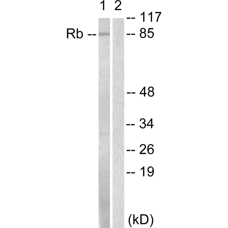 Western Blot - Anti-Retinoblastoma Antibody (B0810) - Antibodies.com
