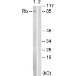 Western Blot - Anti-Retinoblastoma Antibody (B0810) - Antibodies.com