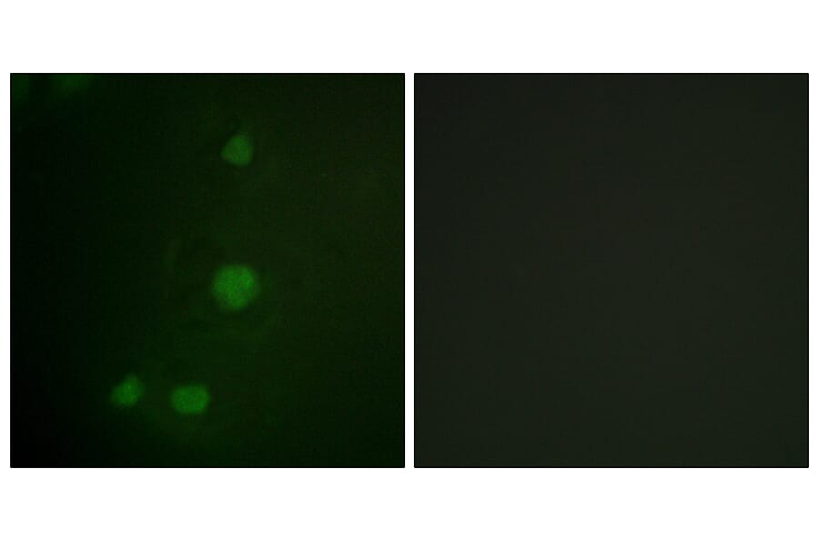 Immunofluorescence - Anti-Retinoblastoma Antibody (B0810) - Antibodies.com