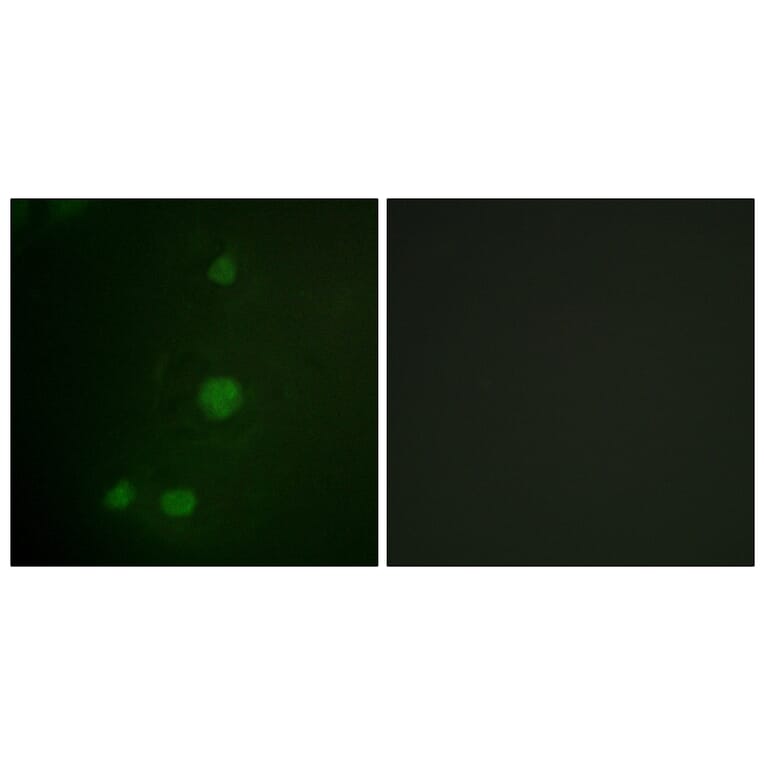 Immunofluorescence - Anti-Retinoblastoma Antibody (B0810) - Antibodies.com