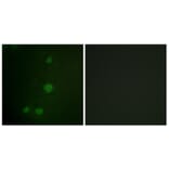 Immunofluorescence - Anti-Retinoblastoma Antibody (B0810) - Antibodies.com
