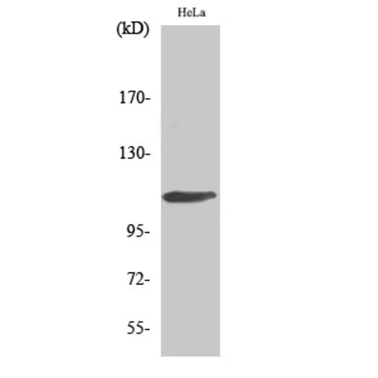 Western Blot - Anti-Retinoblastoma Antibody (B0810) - Antibodies.com