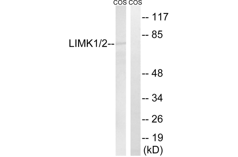 Western Blot - Anti-LIMK1 + LIMK2 Antibody (B0047) - Antibodies.com