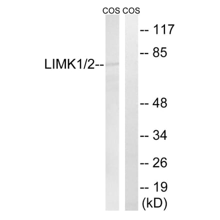 Western Blot - Anti-LIMK1 + LIMK2 Antibody (B0047) - Antibodies.com