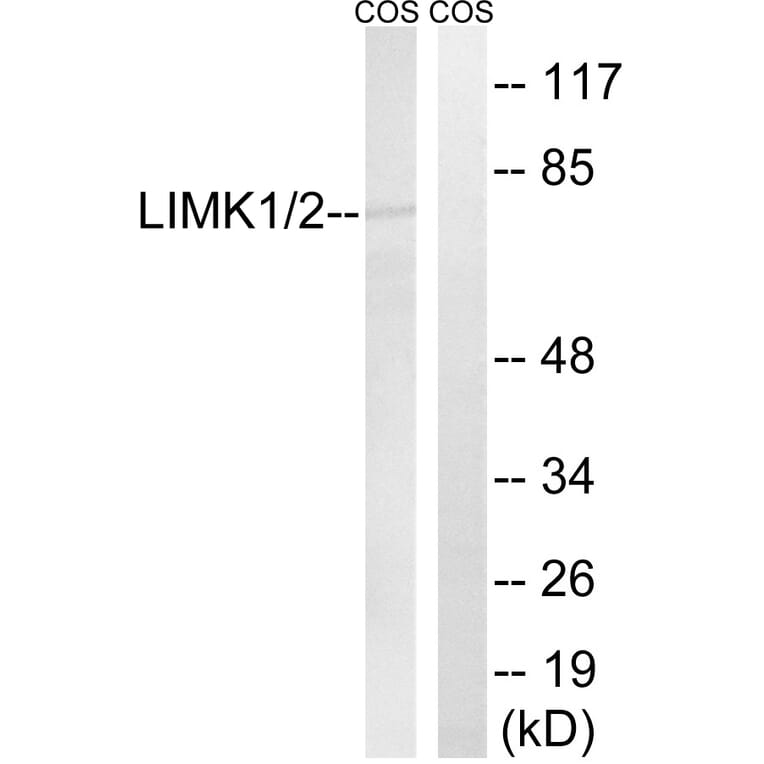 Western Blot - Anti-LIMK1 + LIMK2 Antibody (B0047) - Antibodies.com