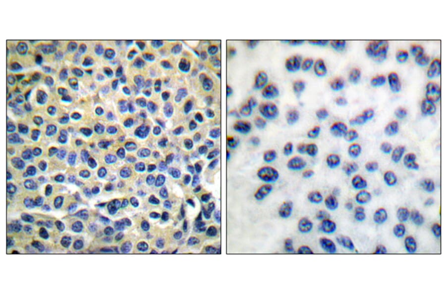 Immunohistochemistry - Anti-LIMK1 + LIMK2 Antibody (B0047) - Antibodies.com