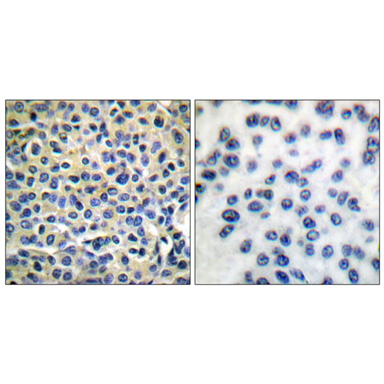 Immunohistochemistry - Anti-LIMK1 + LIMK2 Antibody (B0047) - Antibodies.com