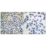 Immunohistochemistry - Anti-LIMK1 + LIMK2 Antibody (B0047) - Antibodies.com