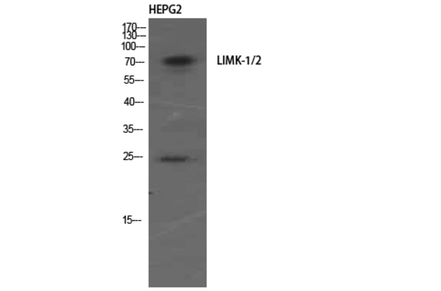 Western Blot - Anti-LIMK1 + LIMK2 Antibody (B0047) - Antibodies.com