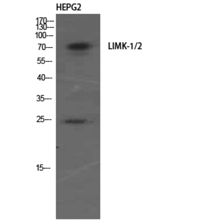 Western Blot - Anti-LIMK1 + LIMK2 Antibody (B0047) - Antibodies.com