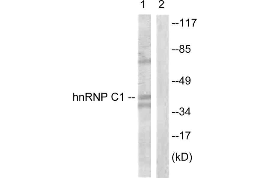 Western Blot - Anti-hnRNP C1 + C2 Antibody (B1041) - Antibodies.com