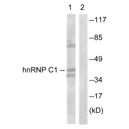 Western Blot - Anti-hnRNP C1 + C2 Antibody (B1041) - Antibodies.com