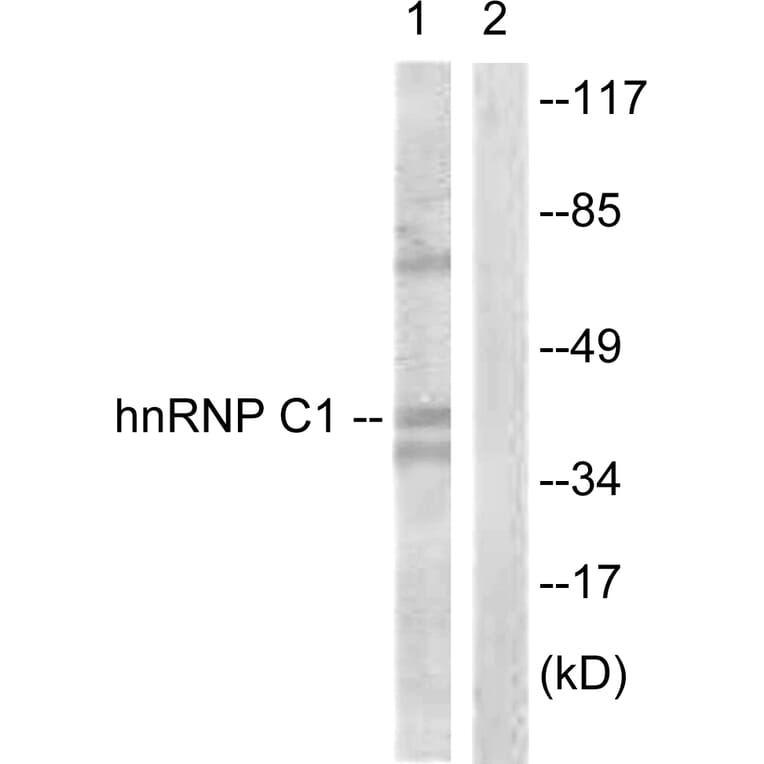 Western Blot - Anti-hnRNP C1 + C2 Antibody (B1041) - Antibodies.com