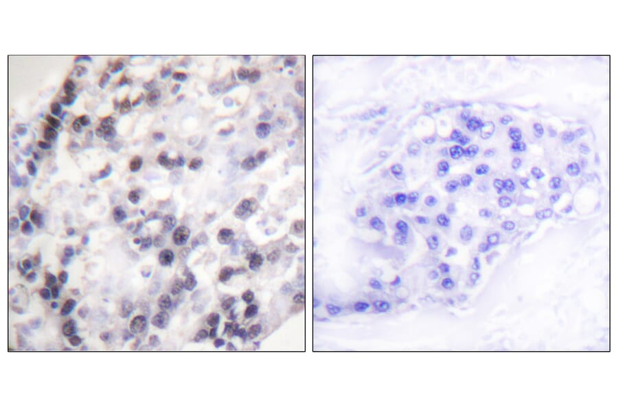 Immunohistochemistry - Anti-hnRNP C1 + C2 Antibody (B1041) - Antibodies.com