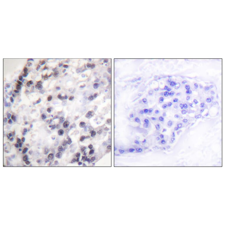 Immunohistochemistry - Anti-hnRNP C1 + C2 Antibody (B1041) - Antibodies.com