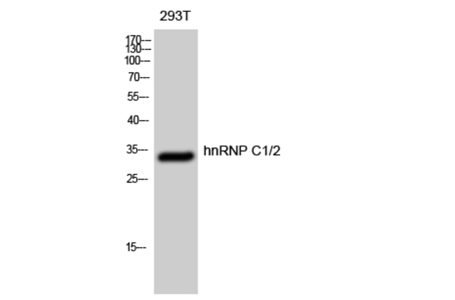 Western Blot - Anti-hnRNP C1 + C2 Antibody (B1041) - Antibodies.com