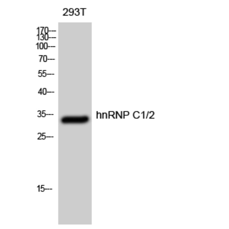 Western Blot - Anti-hnRNP C1 + C2 Antibody (B1041) - Antibodies.com