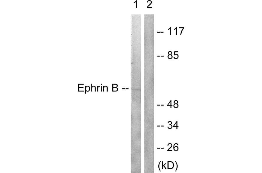 Western Blot - Anti-EFNB1 + EFNB2 Antibody (B0010) - Antibodies.com