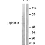 Western Blot - Anti-EFNB1 + EFNB2 Antibody (B0010) - Antibodies.com