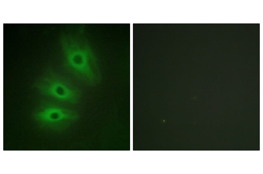 Immunofluorescence - Anti-ADCY5 + ADCY6 Antibody (C12036) - Antibodies.com