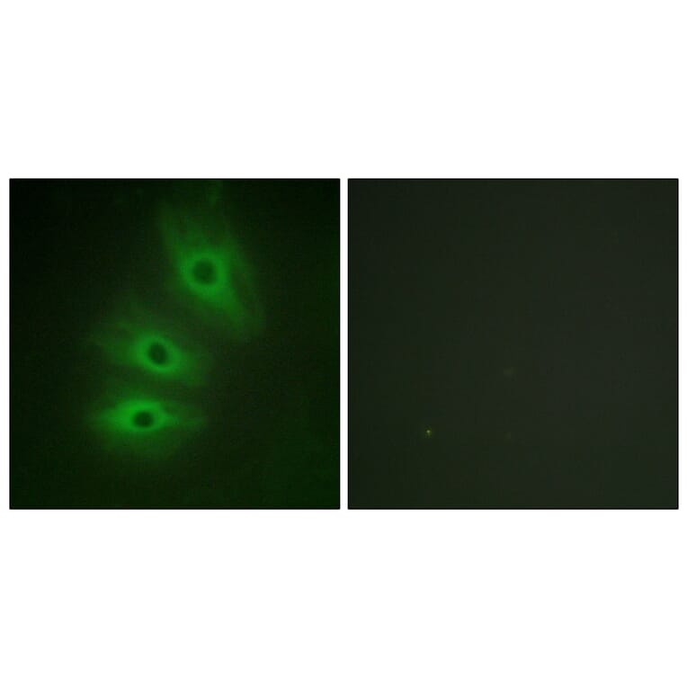 Immunofluorescence - Anti-ADCY5 + ADCY6 Antibody (C12036) - Antibodies.com
