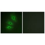 Immunofluorescence - Anti-ADCY5 + ADCY6 Antibody (C12036) - Antibodies.com
