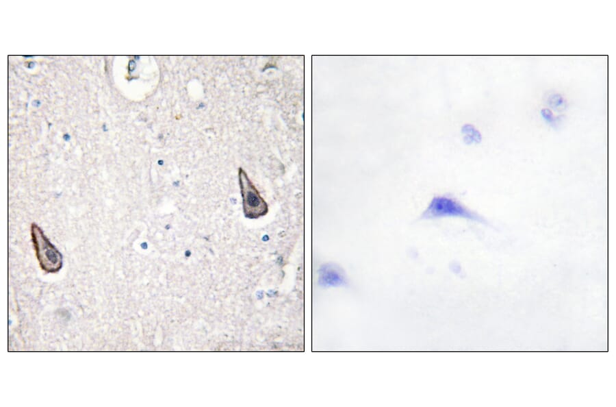 Immunohistochemistry - Anti-ADCY5 + ADCY6 Antibody (C12036) - Antibodies.com