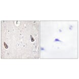 Immunohistochemistry - Anti-ADCY5 + ADCY6 Antibody (C12036) - Antibodies.com