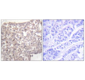 Immunohistochemistry - Anti-Tubulin gamma Antibody (C0381) - Antibodies.com