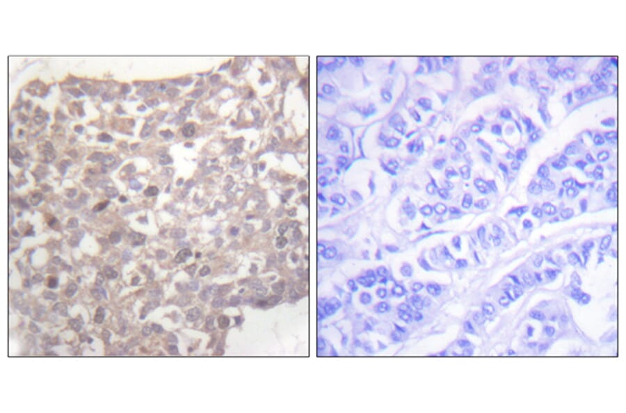 Immunohistochemistry - Anti-Tubulin gamma Antibody (C0381) - Antibodies.com