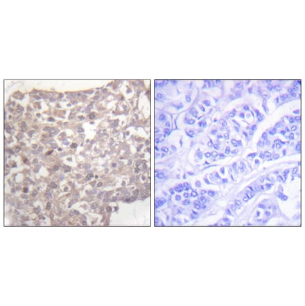 Immunohistochemistry - Anti-Tubulin gamma Antibody (C0381) - Antibodies.com