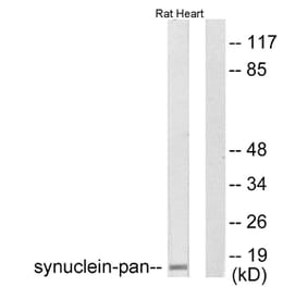 Western Blot - Anti-Synuclein-pan Antibody (C0336) - Antibodies.com