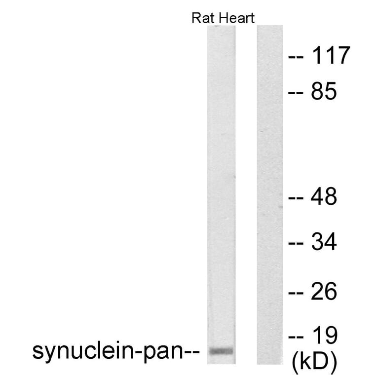 Western Blot - Anti-Synuclein-pan Antibody (C0336) - Antibodies.com