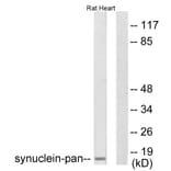 Western Blot - Anti-Synuclein-pan Antibody (C0336) - Antibodies.com