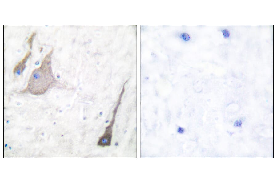 Immunohistochemistry - Anti-Synuclein-pan Antibody (C0336) - Antibodies.com