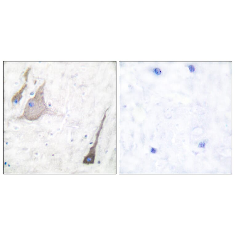 Immunohistochemistry - Anti-Synuclein-pan Antibody (C0336) - Antibodies.com