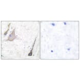 Immunohistochemistry - Anti-Synuclein-pan Antibody (C0336) - Antibodies.com