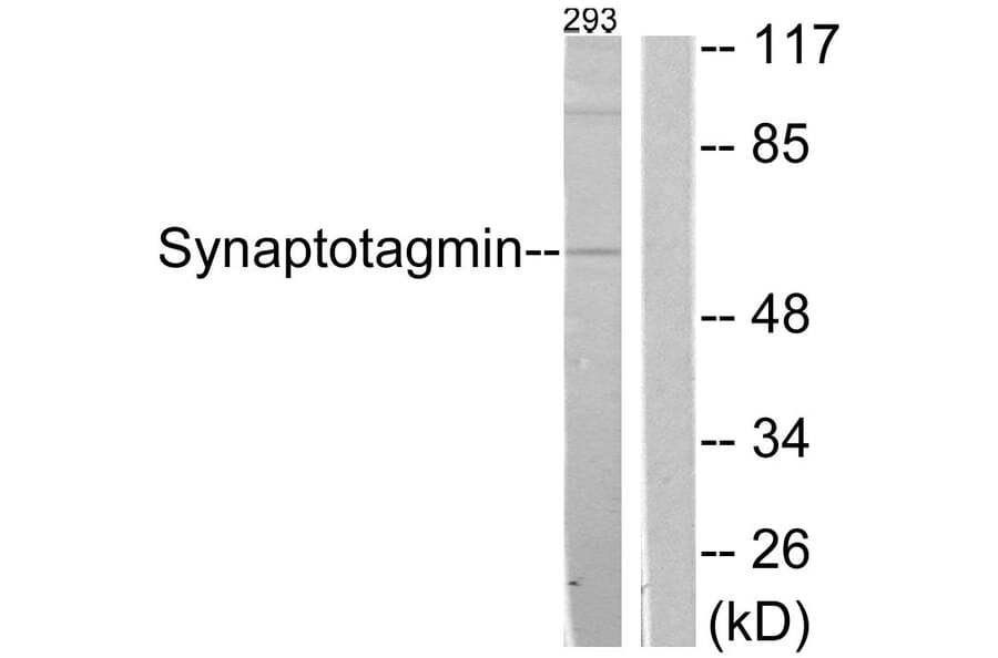 Western Blot - Anti-Synaptotagmin Antibody (B0032) - Antibodies.com