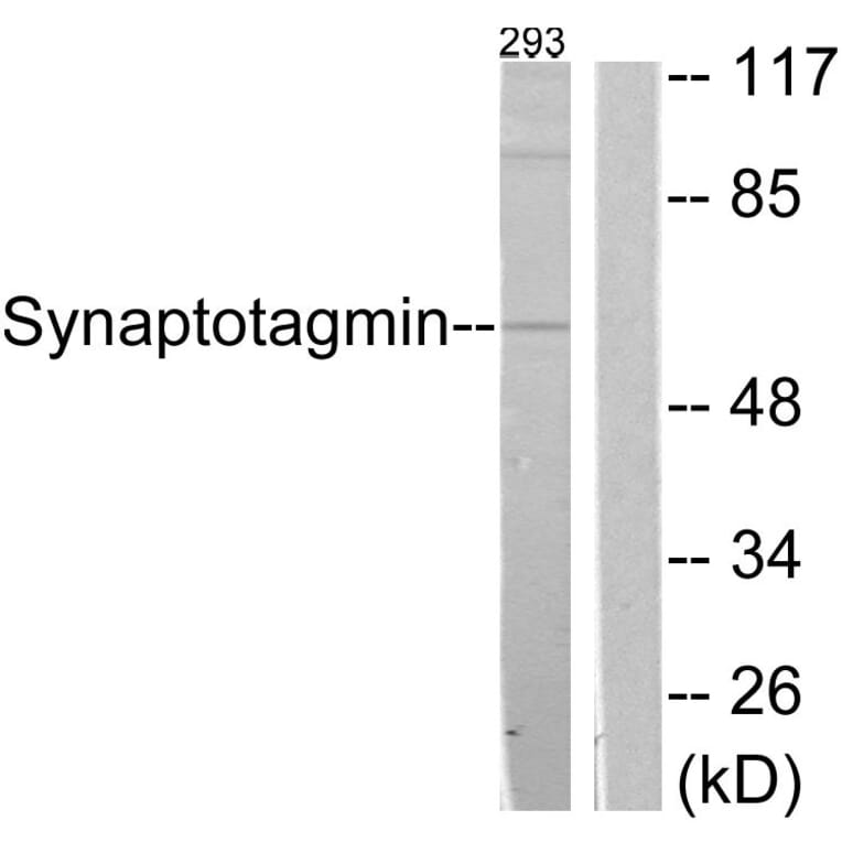 Western Blot - Anti-Synaptotagmin Antibody (B0032) - Antibodies.com