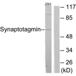 Western Blot - Anti-Synaptotagmin Antibody (B0032) - Antibodies.com