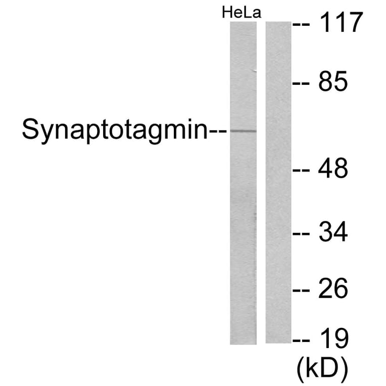 Western Blot - Anti-Synaptotagmin Antibody (B0033) - Antibodies.com