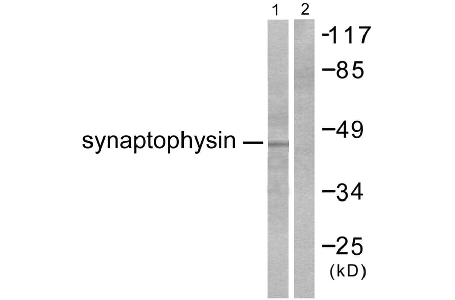 Western Blot - Anti-Synaptophysin Antibody (C0333) - Antibodies.com