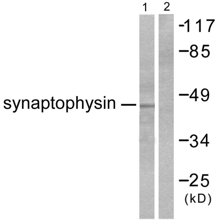 Western Blot - Anti-Synaptophysin Antibody (C0333) - Antibodies.com
