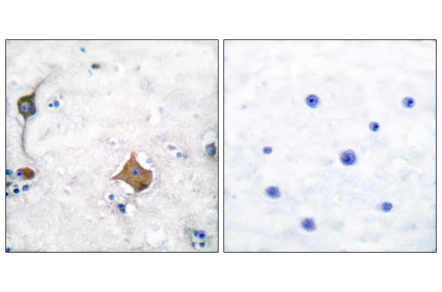 Immunohistochemistry - Anti-Synaptophysin Antibody (C0333) - Antibodies.com