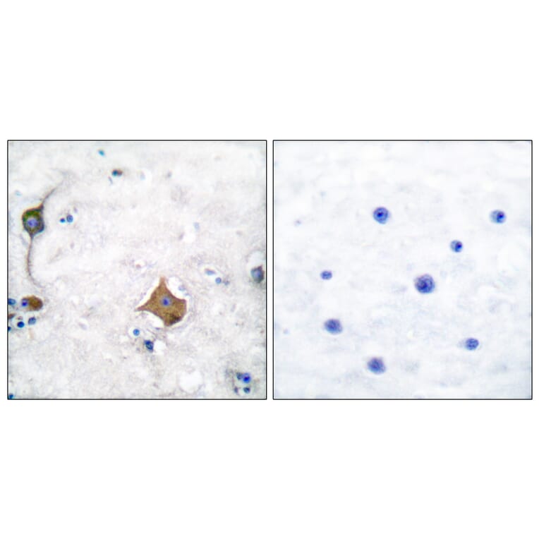 Immunohistochemistry - Anti-Synaptophysin Antibody (C0333) - Antibodies.com