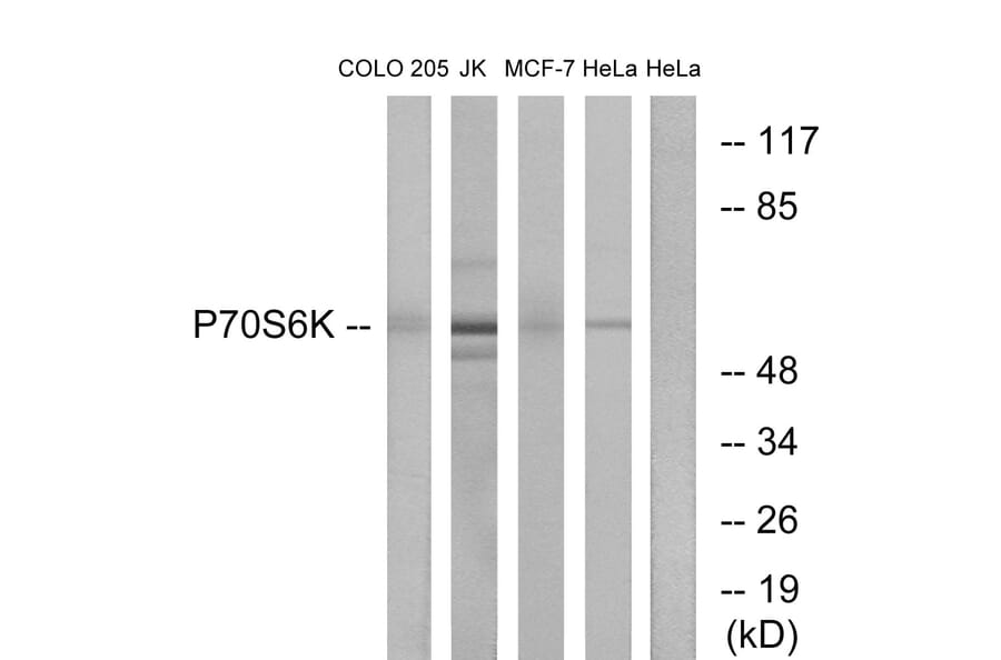 Western Blot - Anti-p70 S6 Kinase Antibody (B0534) - Antibodies.com