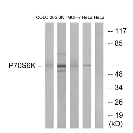 Western Blot - Anti-p70 S6 Kinase Antibody (B0534) - Antibodies.com