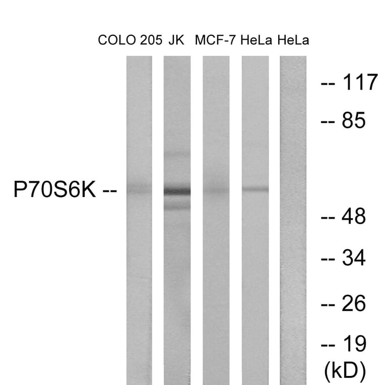 Western Blot - Anti-p70 S6 Kinase Antibody (B0534) - Antibodies.com