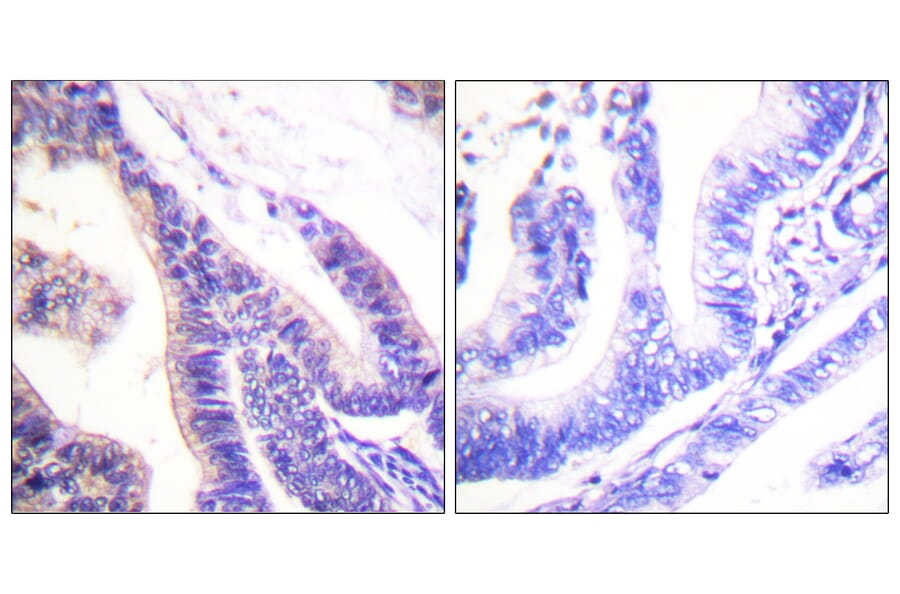 Immunohistochemistry - Anti-p70 S6 Kinase Antibody (B0534) - Antibodies.com
