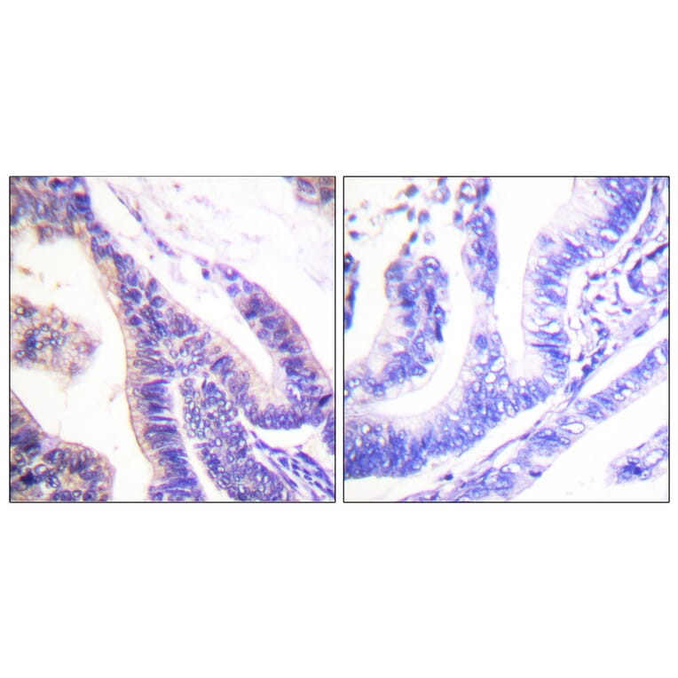 Immunohistochemistry - Anti-p70 S6 Kinase Antibody (B0534) - Antibodies.com